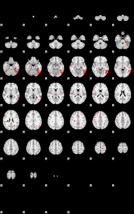 Patients 29733 138