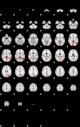 Patients 29737 99