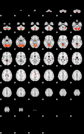 Patients 28679 198