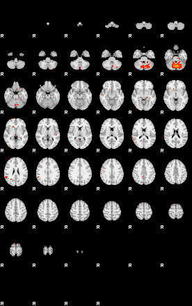 Patients 29010 149