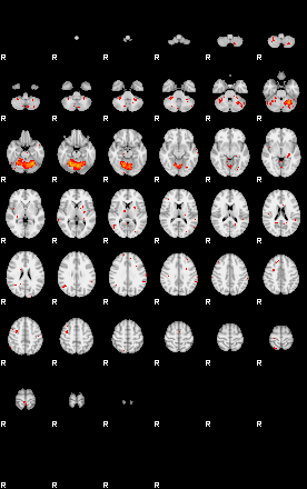 Patients 29013 32