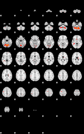 Patients 29015 30