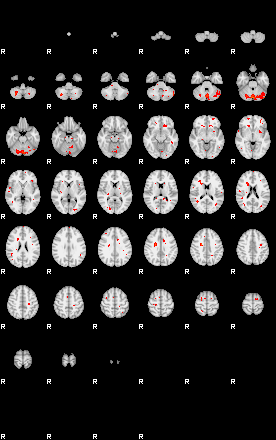 Patients 29015 80