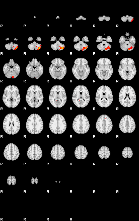 Patients 29060 60