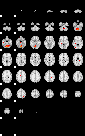 Patients 29107 191