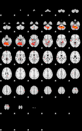 Patients 29159 35