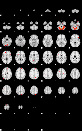 Patients 29163 20