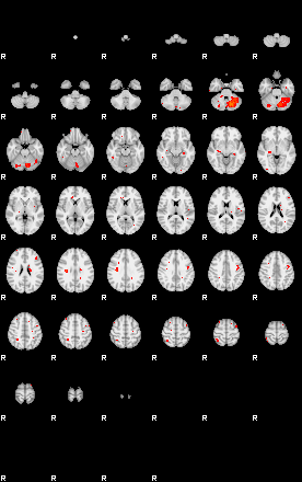 Patients 29170 27