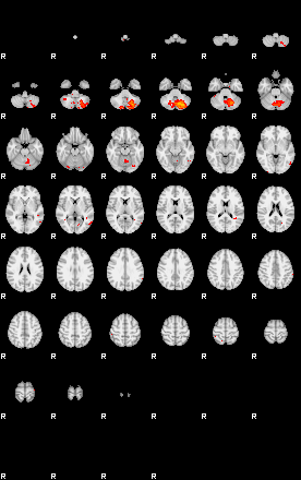 Patients 29180 19