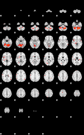 Patients 29184 21