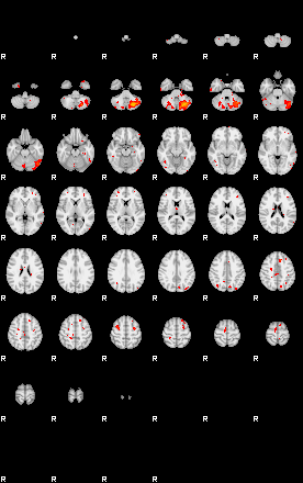 Patients 29219 132