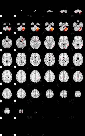 Patients 29411 48