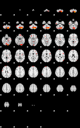 Patients 29433 70