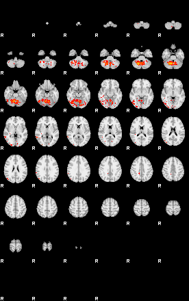 Patients 29510 94