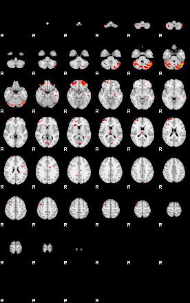 Patients 29539 130