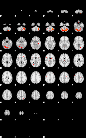 Patients 30010 56