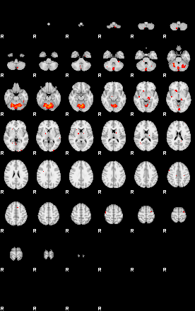 Patients 29112 38