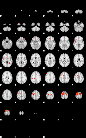 Patients 29006 180