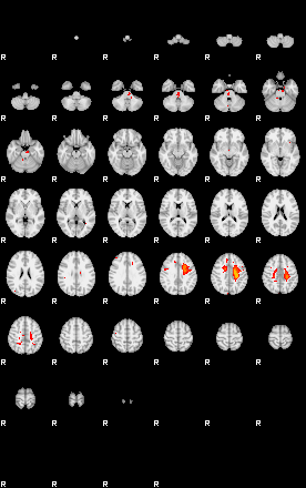 Patients 29031 4