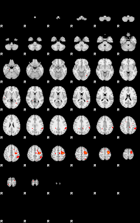 Patients 29176 69