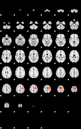 Patients 29391 196