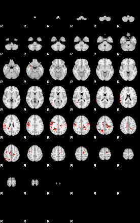 Patients 29180 144