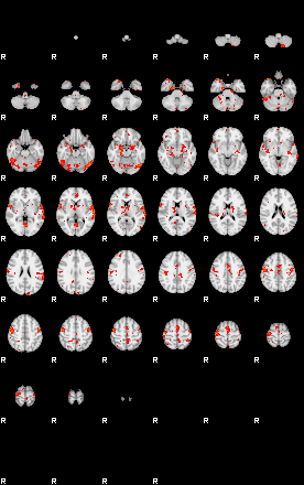 Patients 29181 122