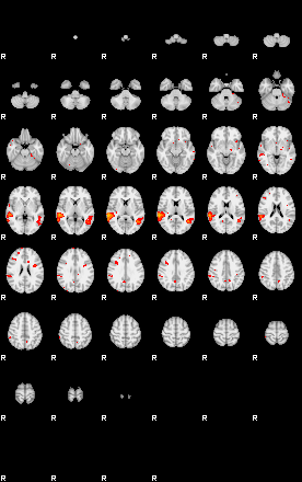 Patients 29155 137