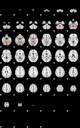 Patients 28691 29