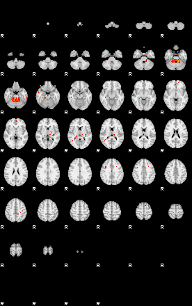 Patients 29008 15