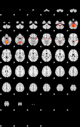 Patients 29055 33