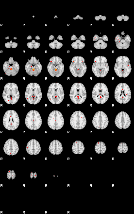 Patients 29153 75