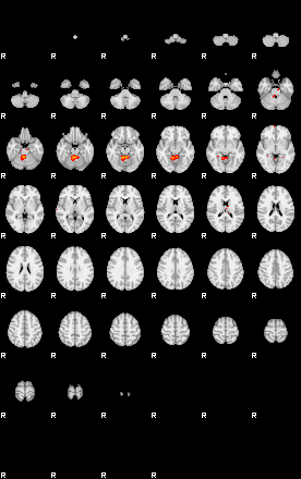 Patients 29173 92