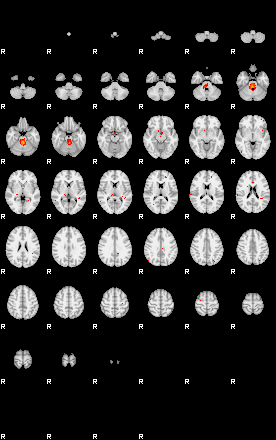 Patients 29174 126