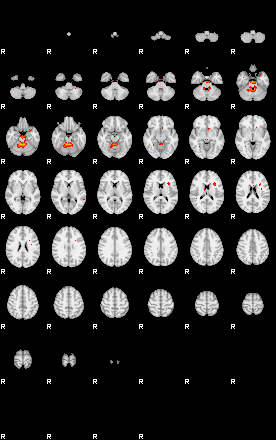 Patients 29290 30