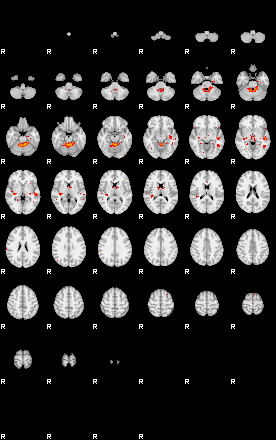 Patients 29410 32