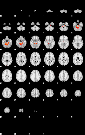 Patients 29412 15