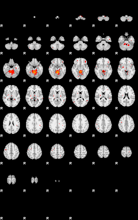 Patients 29502 13