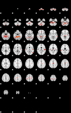 Patients 29587 39