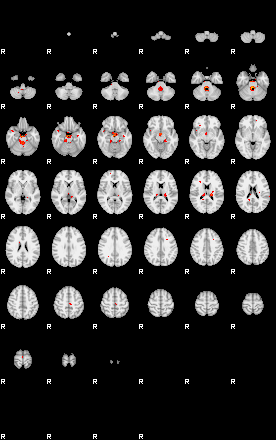 Patients 28761 46