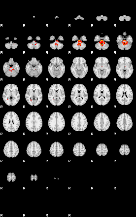 Patients 29401 32