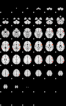 Patients 28692 194