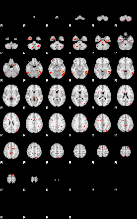 Patients 28935 198