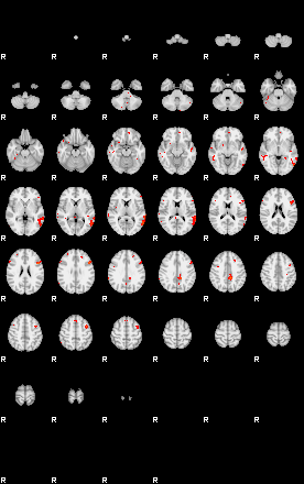 Patients 28949 191