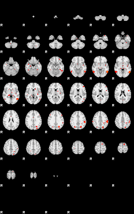 Patients 29007 9