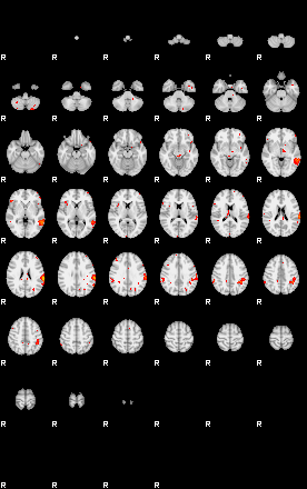 Patients 29010 48