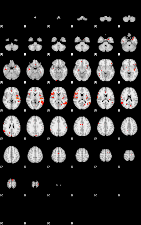 Patients 29013 147