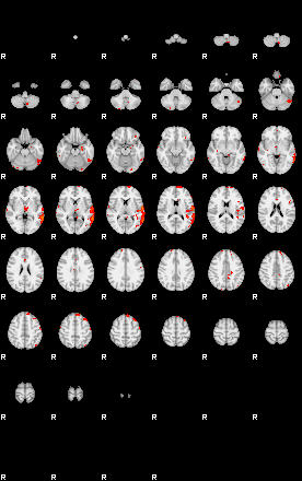 Patients 29070 125