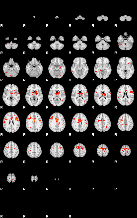 Patients 29100 188