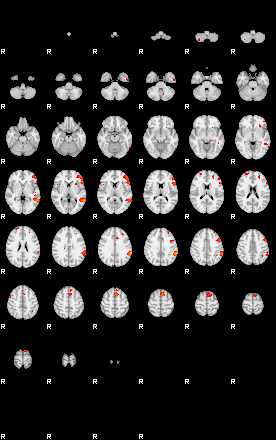 Patients 29107 30